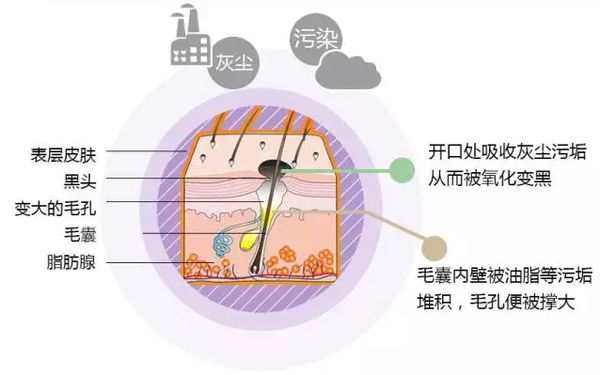黑頭是怎么形成的？黑頭形成的原因有哪些？